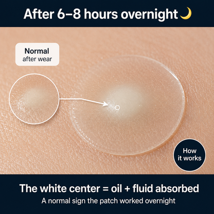 Patchly Overnight Acne Patches