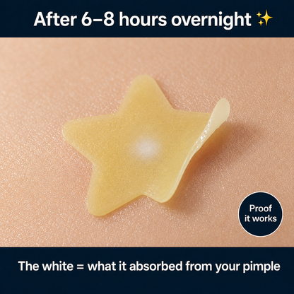 Patchly Star Acne Patches