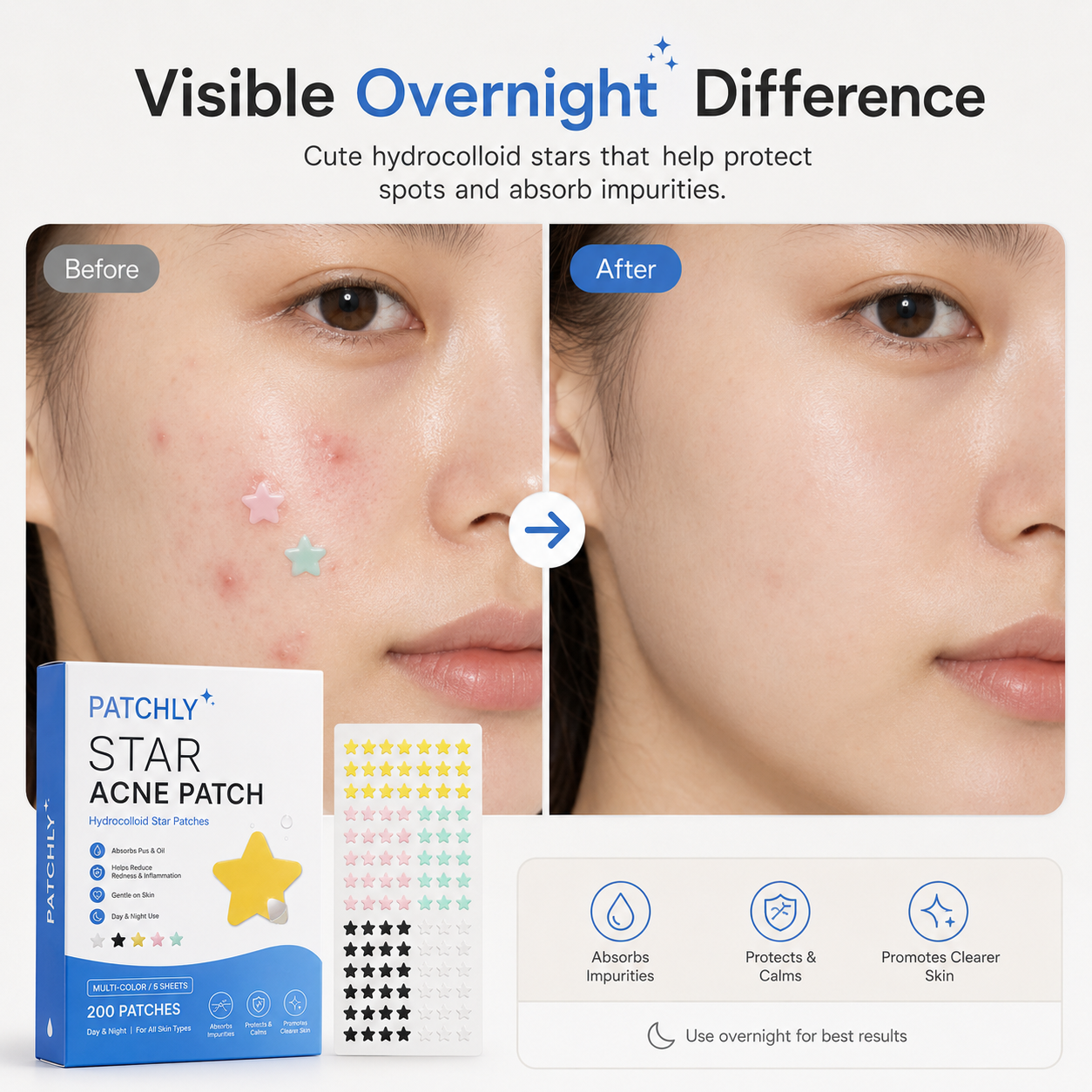 Patchly Star Acne Patches