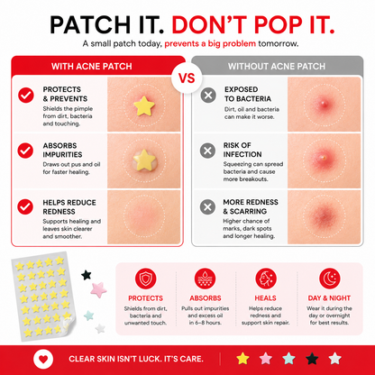 Patchly Star Acne Patches
